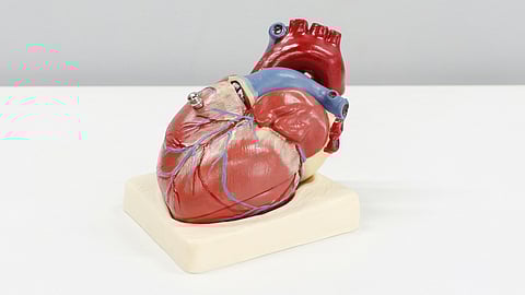 Heart health disparities are widening across socioeconomic groups in the U.S.