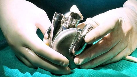 The patient survived for over 100 days with the artificial heart before she was given an early transplant in March.