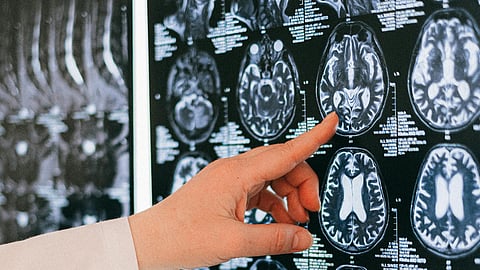 Finger Pointing to a Brain Scan