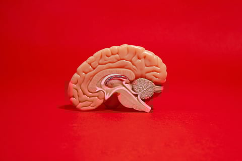 A model of human brain.