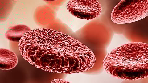 Florida Leads U.S. in Leukemia Rates.