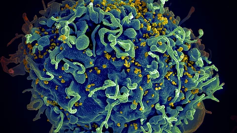 HIV treatment may get a boost following this new study.