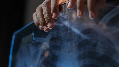 A kid Holding an X-Ray Film