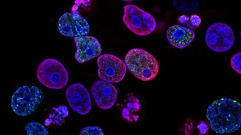 Microscopic view of fluorescent dyed cells highlighting nuclei and other cell components