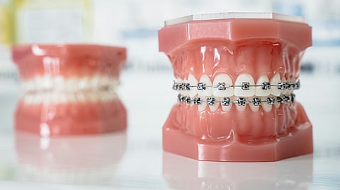 A tooth model with braces
