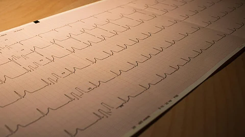 An ECG paper on a table with a heart monitor