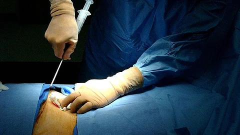 A surgeon is performing surgery.