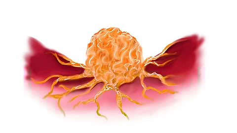 The image shows a malignant tumor.