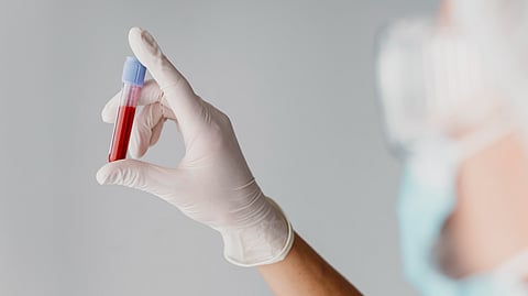 A person holding a vial of blood in a gloved hand.
