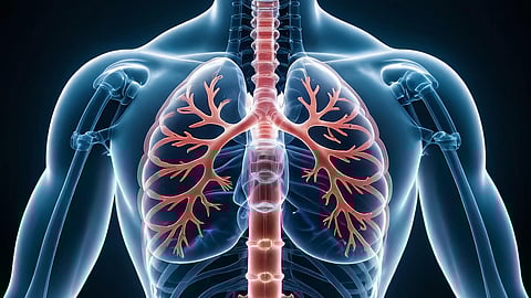 The image shows the human lungs.