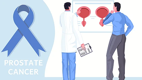 An illustration about prostate cancer with a healthcare professional and a patient discussing about it.