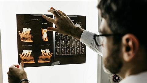 A doctor examining the CT scan of tooth