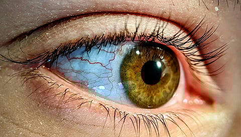 A close-up of a human eye