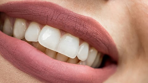 Close-up of a smiling mouth showcasing bright, white teeth
