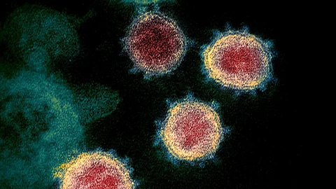 This colorized transmission electron microscope image shows SARS-CoV-2.