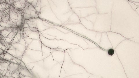 Aspergillus Niger Micrograph