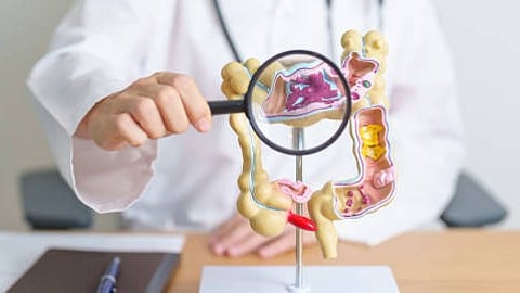 A doctor examining a 3D model of the large intestine, magnifying a specific section for detailed study.