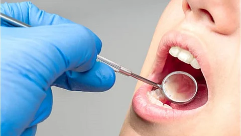 A close-up image of an oral cavity being examined with the help of a mouth mirror.