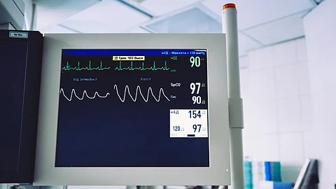 A hospital monitor displaying vital signs.