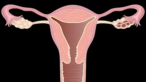 Illustration of the female reproductive system, showing the uterus, fallopian tubes, and ovaries.