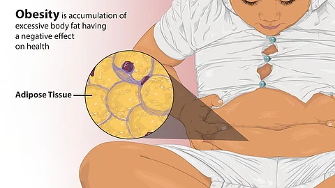 Depiction of a teenage with obesity.