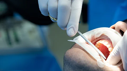 A close-up image showing a dentist putting sutures after a dental surgery in an oral cavity.