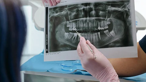 Doctor showing OPG x ray report to a patient.