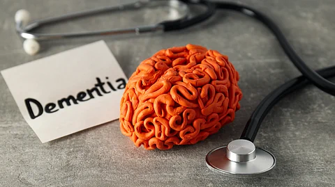 A model of human brain in an orange color and paper note with dementia written on it and a stethoscope lying nearby.