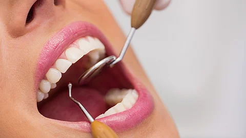 A dentist examining a patient's mouth.
