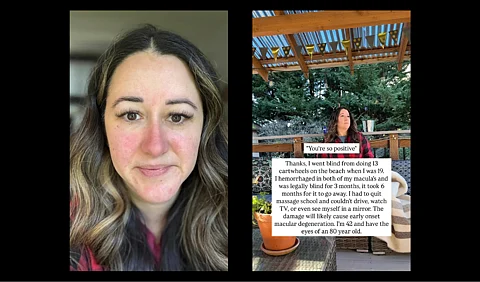 In May 2002, Deborah Cobb, a 19-year-old from Seattle, performed 13 cartwheels in a row on Westport beach in Washington while enjoying a day with friends. After collapsing from dizziness, she noticed her vision blurred.