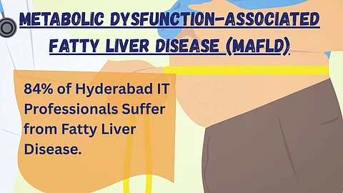 Image showing details about MAFLD.