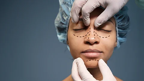 Image of a woman getting markings for a rhinoplasty done.