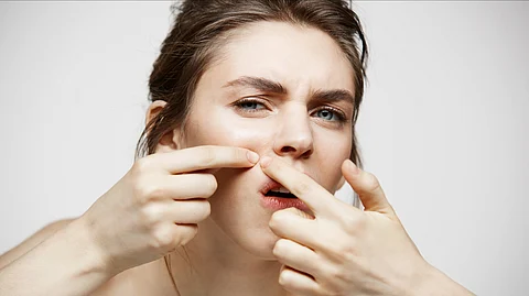 A young woman picking up her acne.