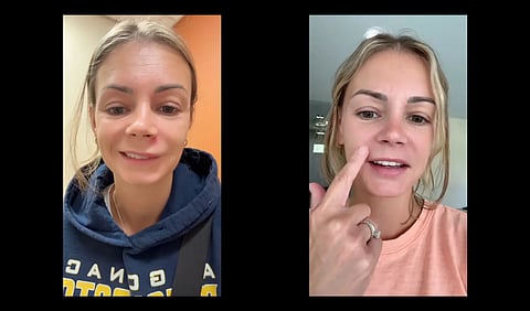 Lish Marie showing her pimple