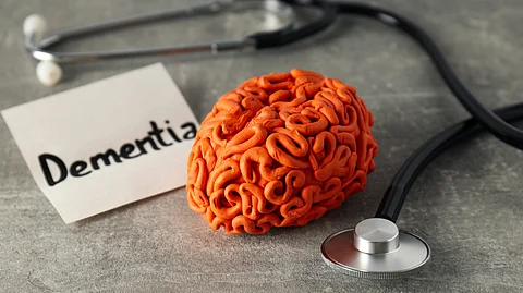 Image having graphics of a brain, stethoscope and a note having Dementia written on it.