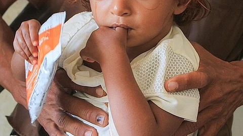 Image shows a malnourished baby held by an adult.