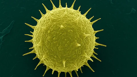 Image shows colorized scanning electron microscope image of a T cell.