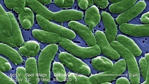 False color scanning electron micrograph of w:en:Vibrio vulnificus bacteria