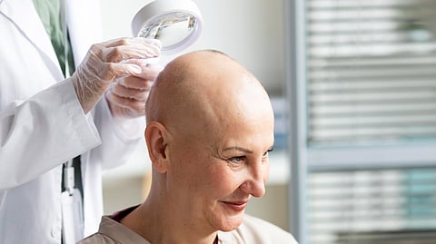 Doctor checking patient who has suffered from hair loss due to cancer.