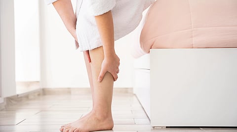 Image of woman's legs suffering from Lymphedema.