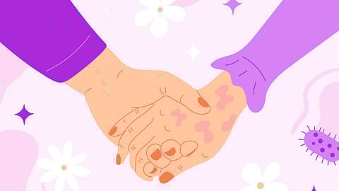 Illustration depicting leprosy.