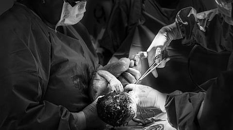 An image of a delivery session in hospital.