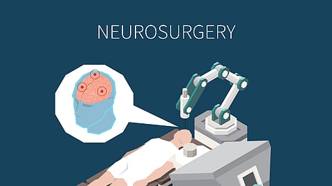 Image showing graphics showing neurosurgery practices.
