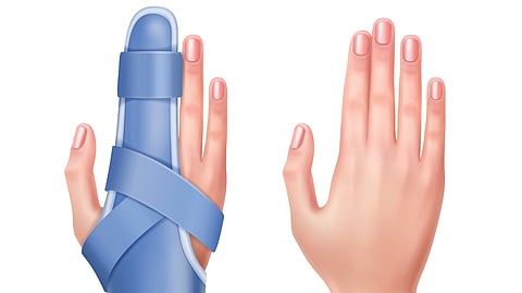 Empty hand and trauma of hand with finger in splint.