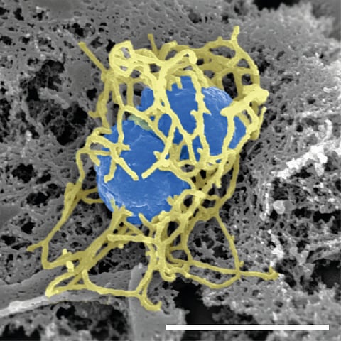 Scanning electron micrograph of a single N. meningitidis cell (colorized in blue) with its dense meshwork of pili (colorized in yellow).