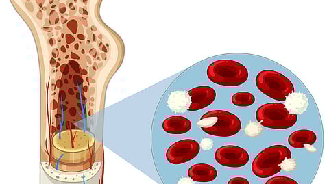 Cross-section of a bone showing spongy tissue and marrow. Inset illustrates red and white blood cells.