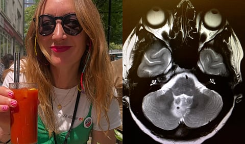 Lowri Denman and her scans