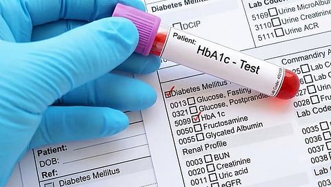 An HbA1c blood sample tube shown alongside a lab requisition form listing related tests