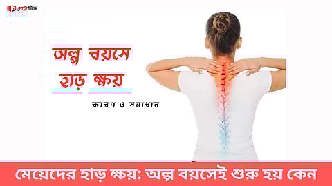 মেয়েদের হাড় ক্ষয়: অল্প বয়সেই শুরু হয় কেন