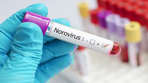 വയനാട് നോറോ വൈറസ് സ്ഥിരീകരിച്ചു; 98 വിദ്യാർഥികൾ ചികിത്സ തേടി